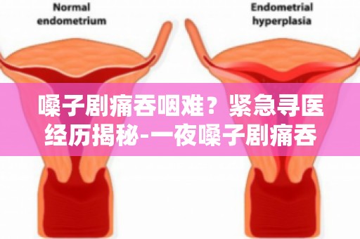 嗓子剧痛吞咽难？紧急寻医经历揭秘-一夜嗓子剧痛吞咽难,紧急寻医记
