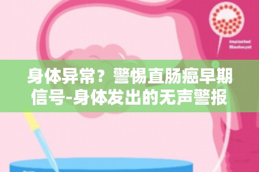 身体异常？警惕直肠癌早期信号-身体发出的无声警报解读