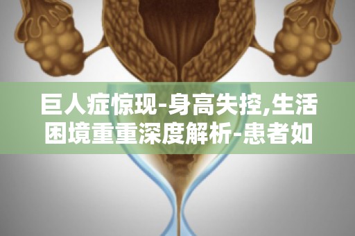 巨人症惊现-身高失控,生活困境重重深度解析-患者如何应对