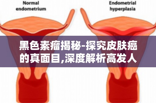 黑色素瘤揭秘-探究皮肤癌的真面目,深度解析高发人群及病因