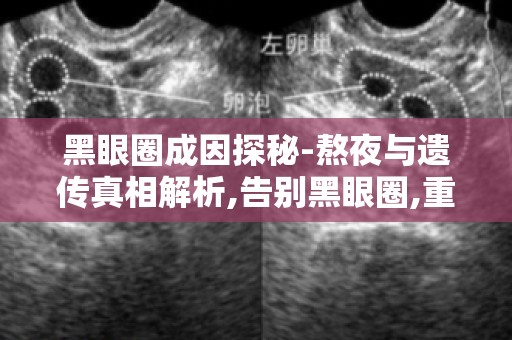黑眼圈成因探秘-熬夜与遗传真相解析,告别黑眼圈,重拾青春光彩！
