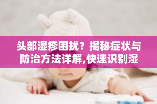 头部湿疹困扰？揭秘症状与防治方法详解,快速识别湿疹症状！